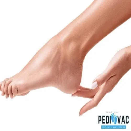 Vacuum Callus Remover And Collector