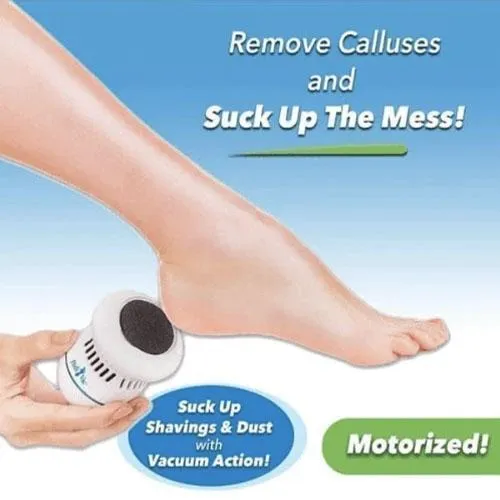 Vacuum Callus Remover And Collector
